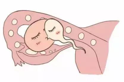 生殖妇科